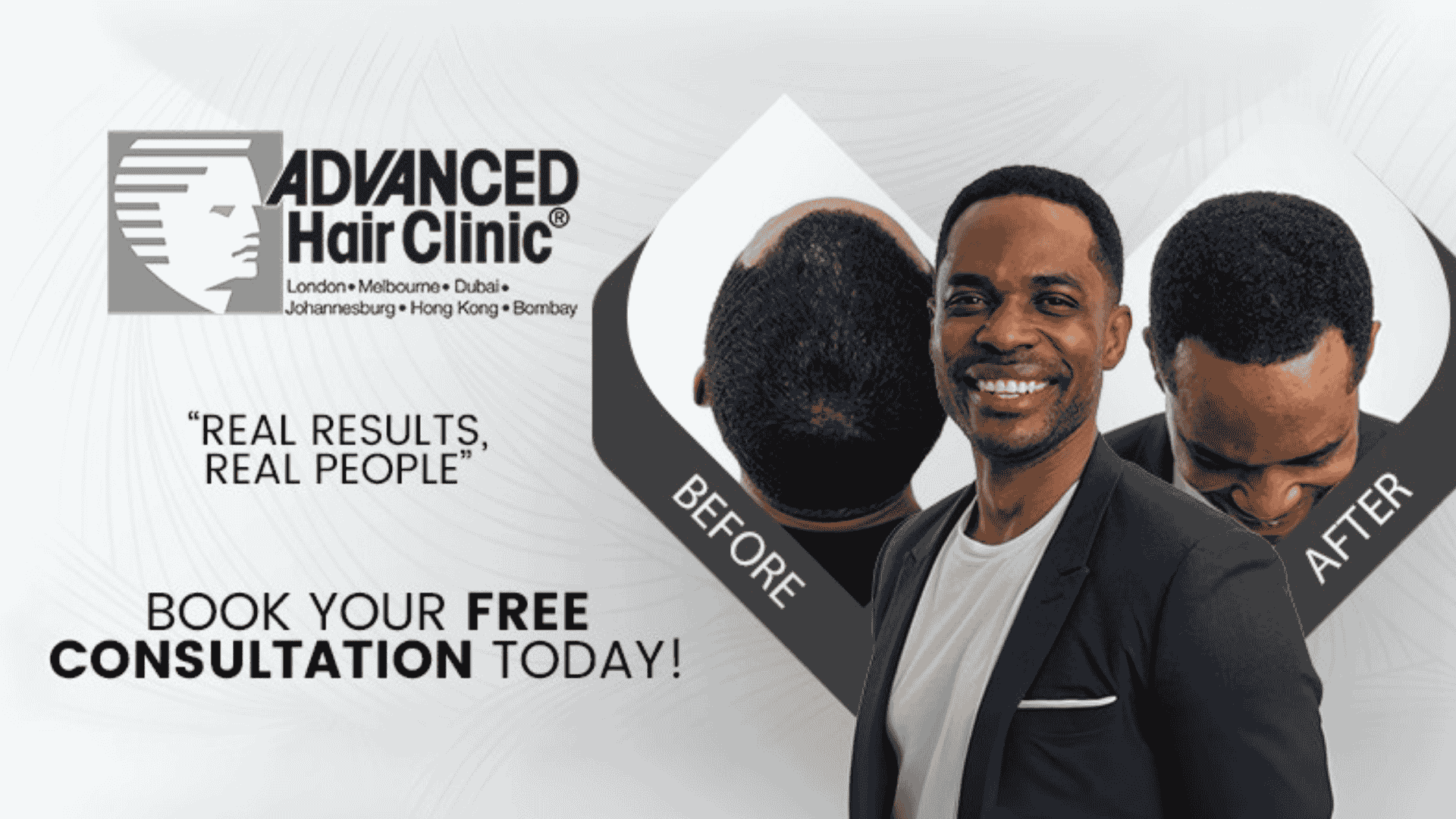 A smiling man stands in front of before and after images showing restored hair—proof you don’t have to let brainrot over hair loss win. ADVANCED Hair Clinic: real results, real people. Book your FREE consultation today! Locations are listed above.